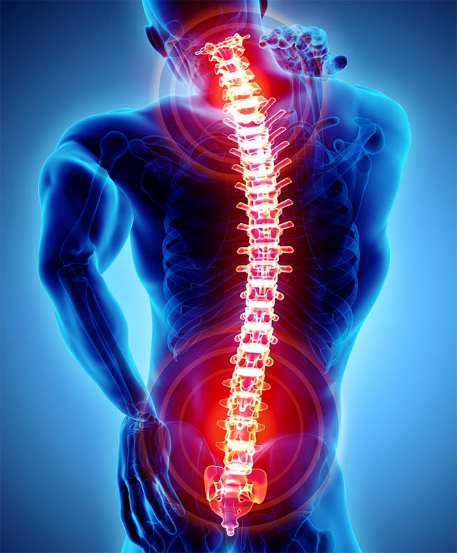 Spinal Disc Injuries